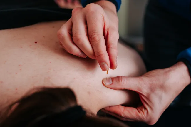 Dry Needling van Eijk