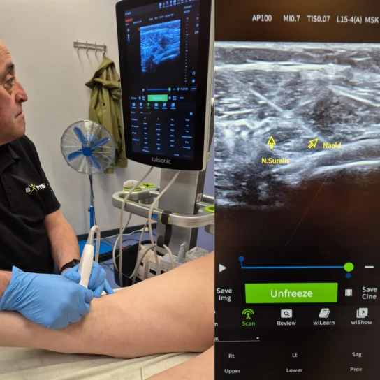 NMP neuromodulatie Percutaan behandeling echografie