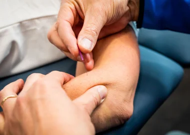 Dry needling Eindhoven
