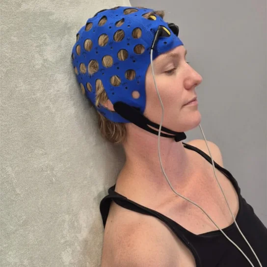 tDCS innovatieve vorm van neuromodulatie bij B-Fysic